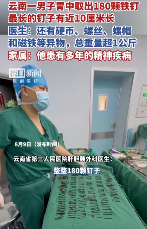 太吓人了！云南，一男子反复呕吐腹痛9天，拍X光片竟发现胃里塞满密密麻麻的金属异物