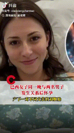 不可思议，巴西一女子同一晚上和两名男子发生关系后怀孕，产下一对双胞胎，八个月后亲