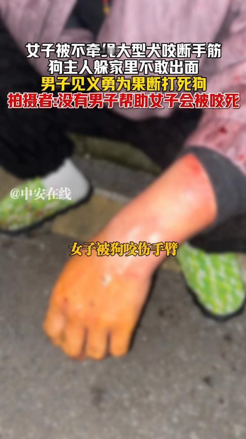 “必须严惩！”12月9日，湖南株洲，一大妈晚上散步时，被一条没拴绳的大狗死死咬住