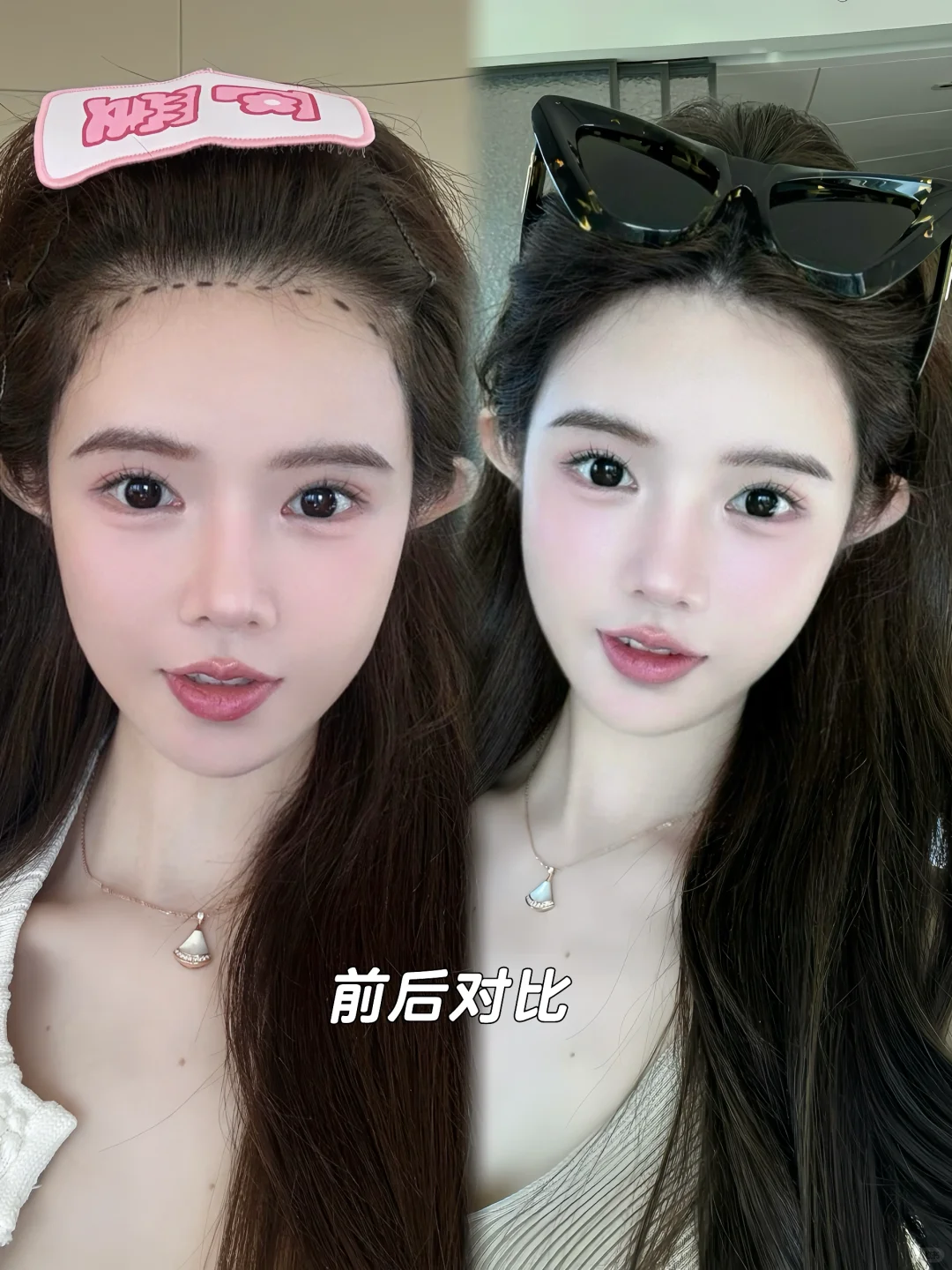 悄悄做了个发际线 头包脸 这不就有了吗 平时一直都用际线粉 但是感觉真...