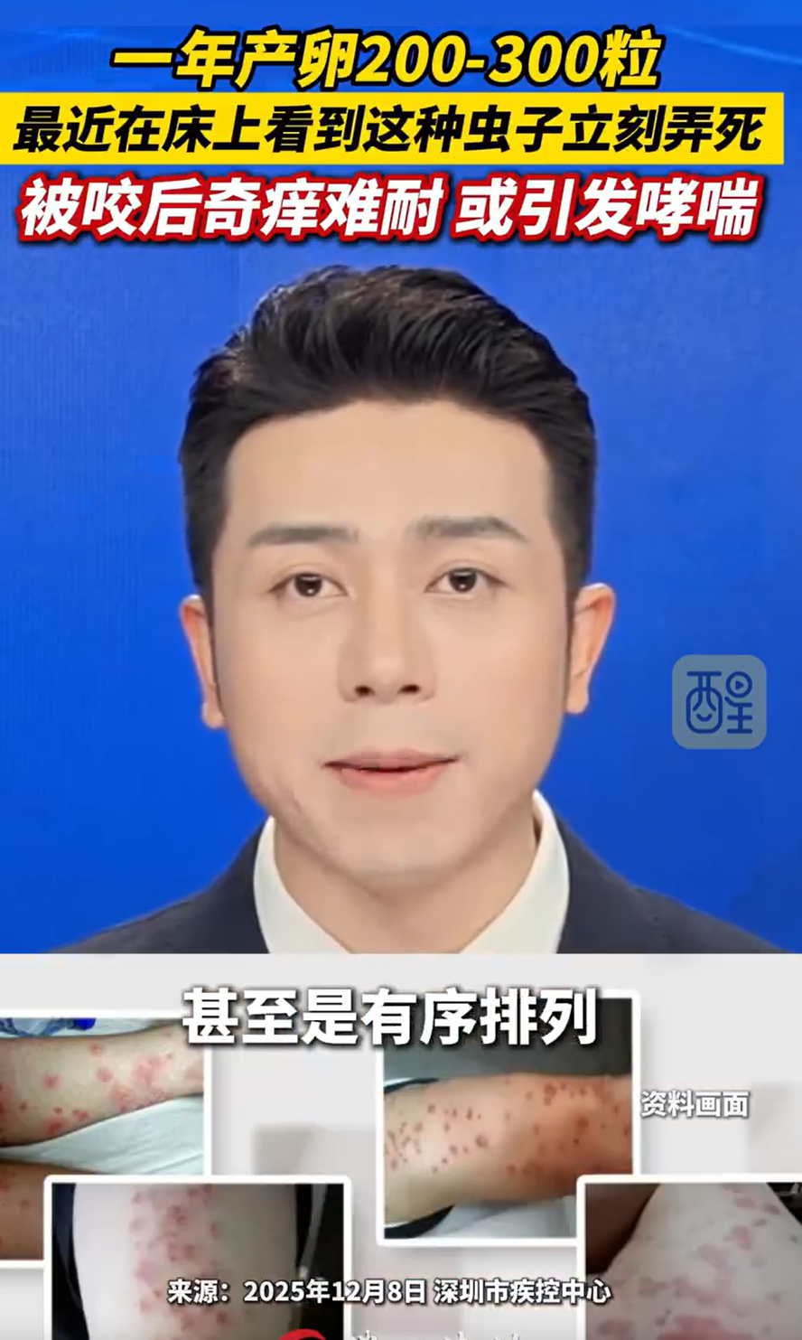 几乎灭绝的床虱为何又卷土重来 这东西80年代小时候家里见过，院子里养猫又养狗后来
