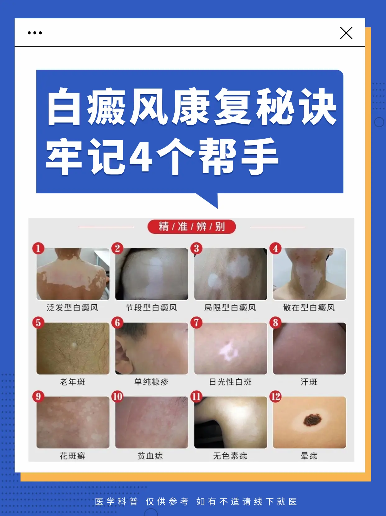 医学科普 白癜风 白癜风科普 白癜风患者 硬核健康科普行动