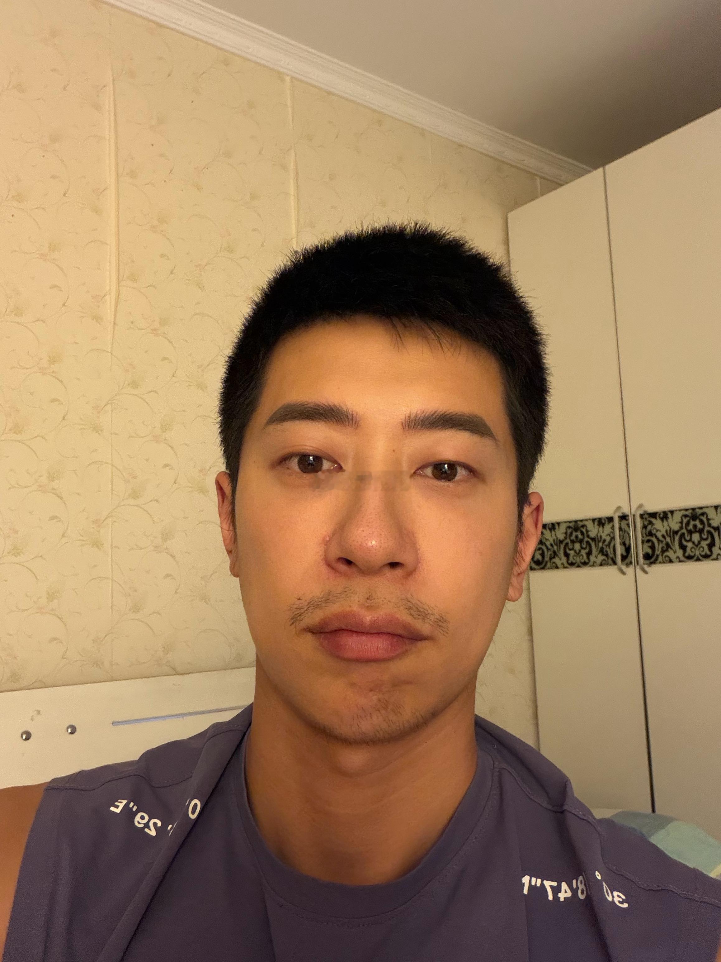 长了个痘痘麦抠抠我的日常plog