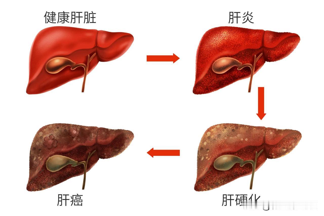 肝为刚脏，体阴而用阳，中医看肝脏的“双面性格”
 
中医常说“肝为刚脏，体阴而用