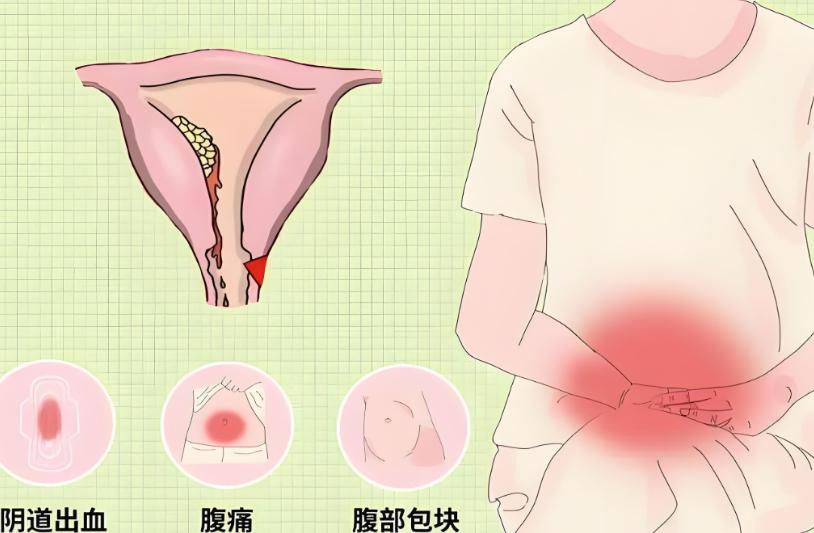 女性月经异常伴随三个信号，可能是子宫肌瘤，别拖着不查

门诊上有位35岁的女性，