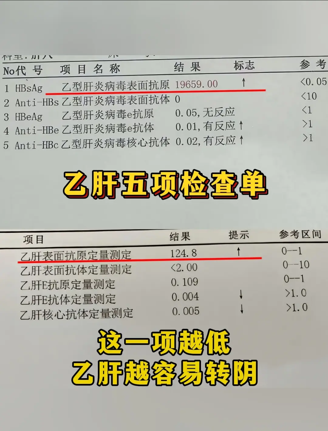 乙肝表面抗原越低，转阴的机会越大，尤其是低于1500，属于乙肝转阴优势...