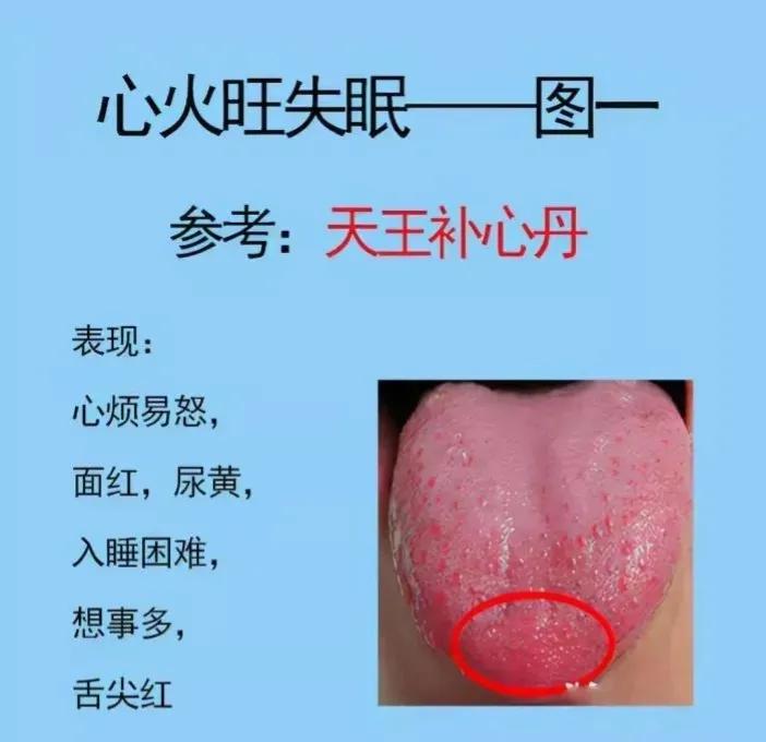 你是否经常凌晨3点-5点早醒，入睡难、醒得早，睡眠质量差呢？这可能是失眠的症状，