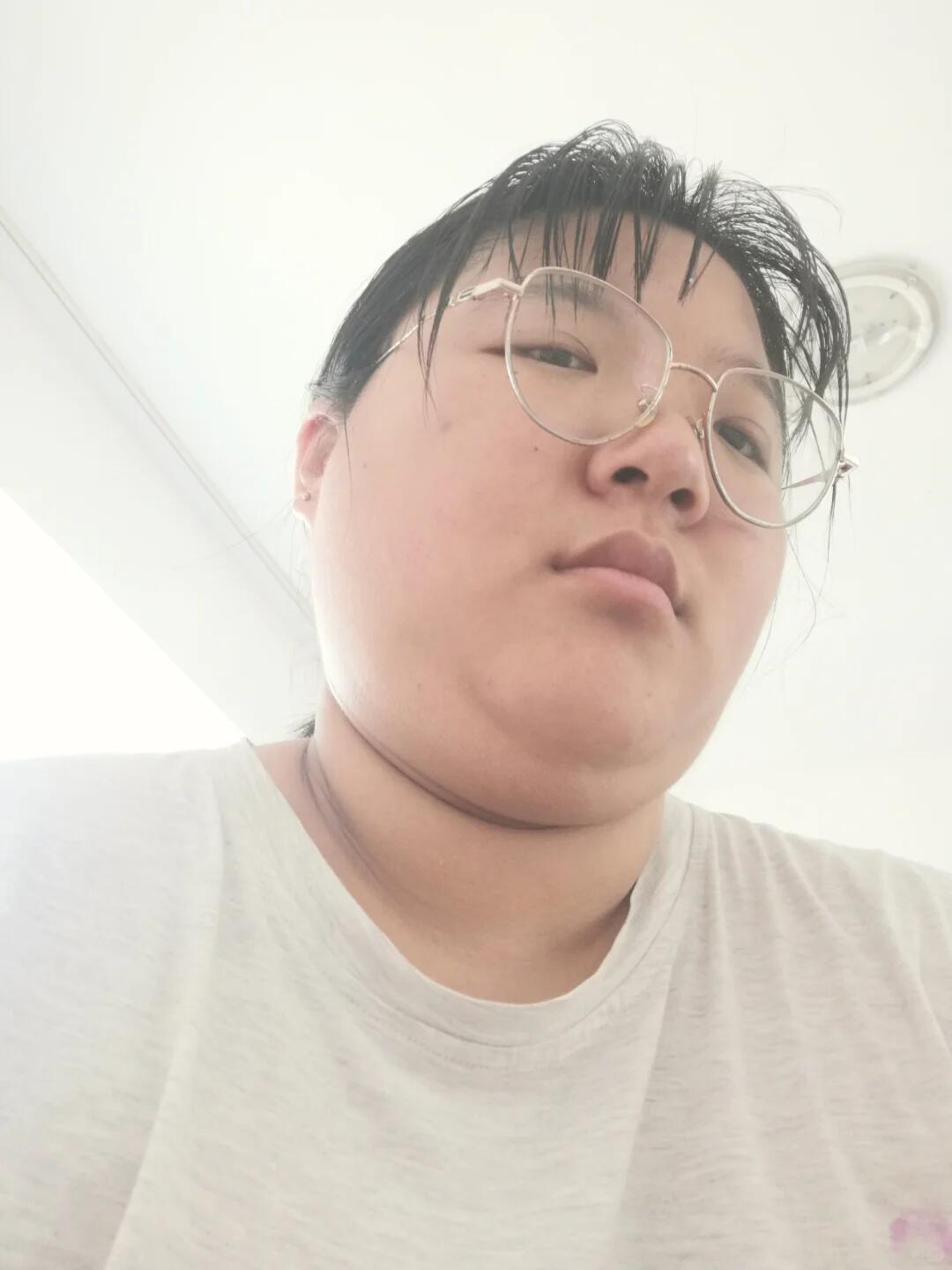 多囊，戒糖+降雄1年，素颜已达next level
