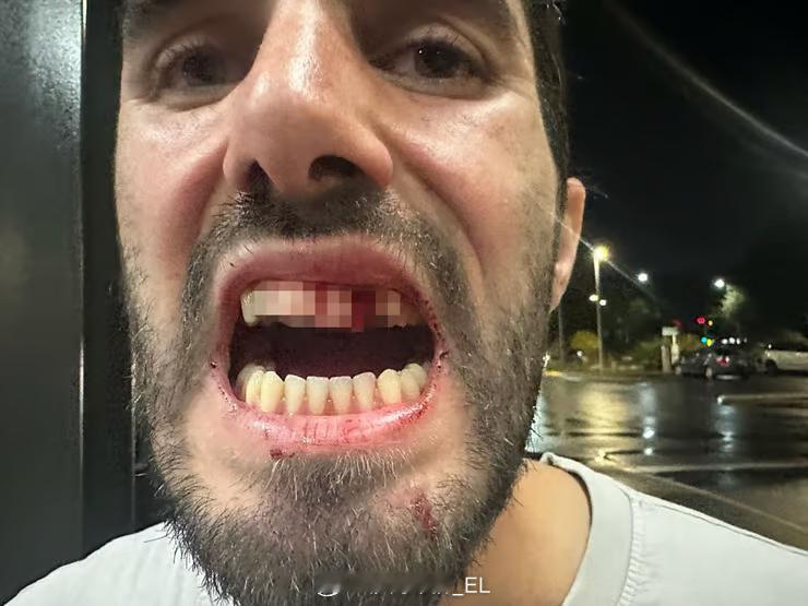 一名以色列预备役军人尤瓦尔·谢克尔在新西兰基督城的酒吧里因为泄露自己身份挨揍，被