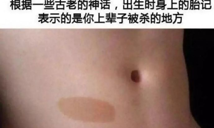你的胎记在哪 ​​​