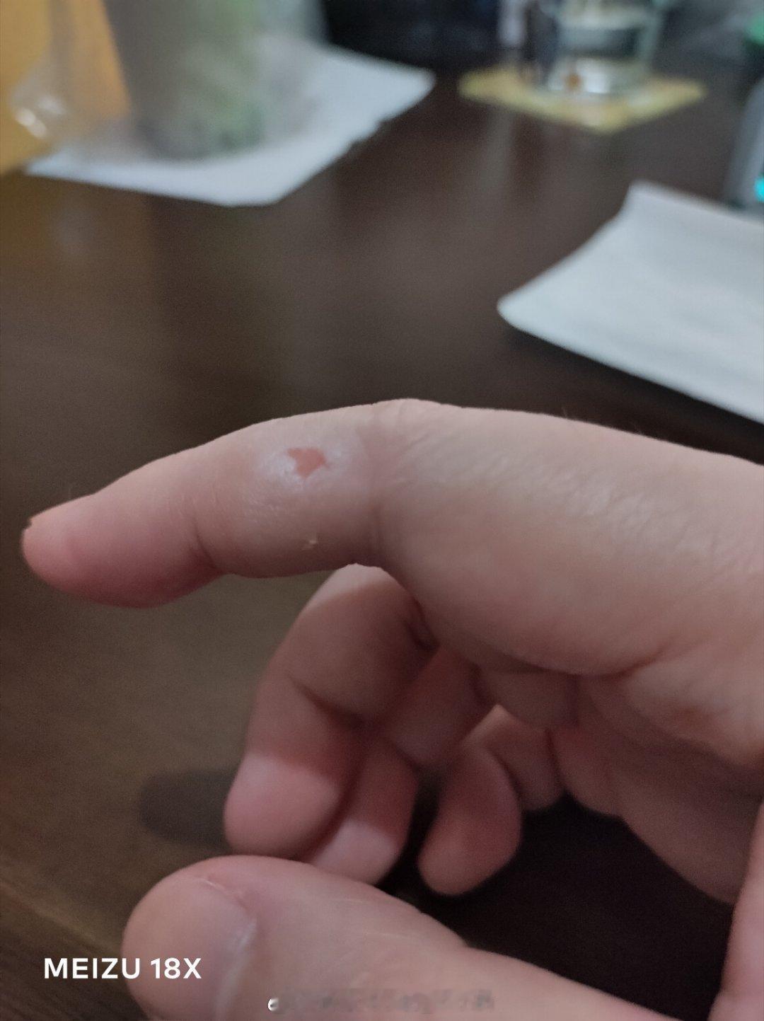 这个月多灾多难，又是电脑蓝屏稿没存上又是手皮磨掉的，这酒茨活动赶不赶得上哦 ​​