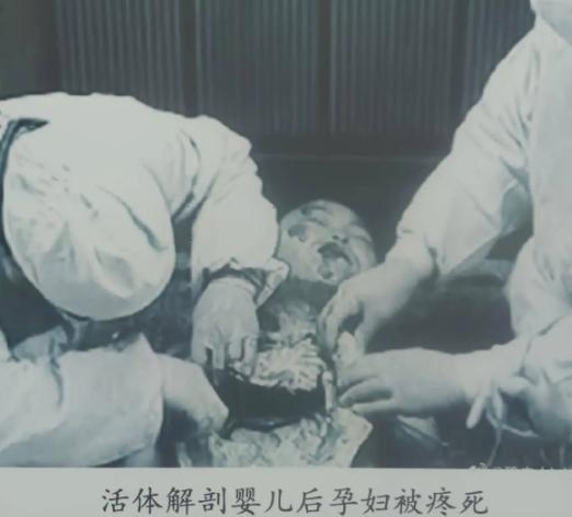不少人清楚731部队手段残暴，却不清楚其暴行早已冲破人性底线，这支假借防疫给水之