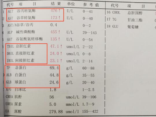 看不懂的肝功能报告单，这次可算看懂了！