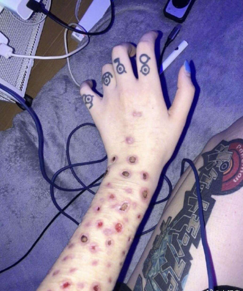 最近，日本社交媒体上出现了一种让人瞠目结舌的现象——部分年轻女性公开展示手臂上的