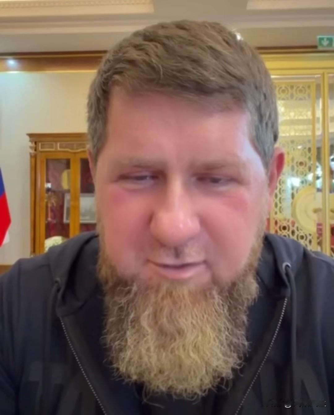 车臣共和国领导人卡德罗夫就格罗兹尼政府大楼遭乌军无人机袭击称:“从明天开始，接下