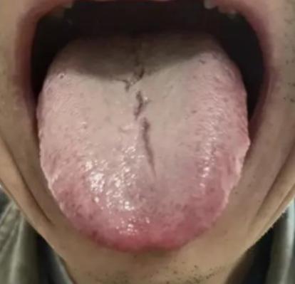 这个大哥想要补肾，想问问有什么好建议！说实话还真有，不过调理时要切记进补顺序不能