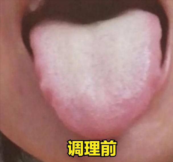 其实舌头就是咱们身体内部的一面镜子，看一眼就能够反映出咱们五脏六腑的好坏！

下