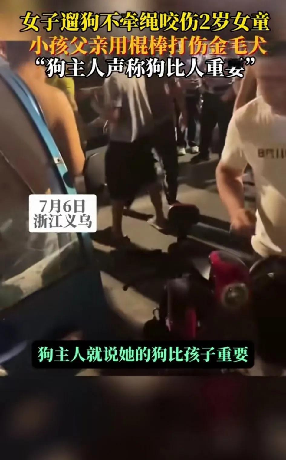 浙江义乌一女子遛狗不牵绳，导致狗咬伤女童，孩子父亲打伤金毛犬，狗主人竟然口出狂言