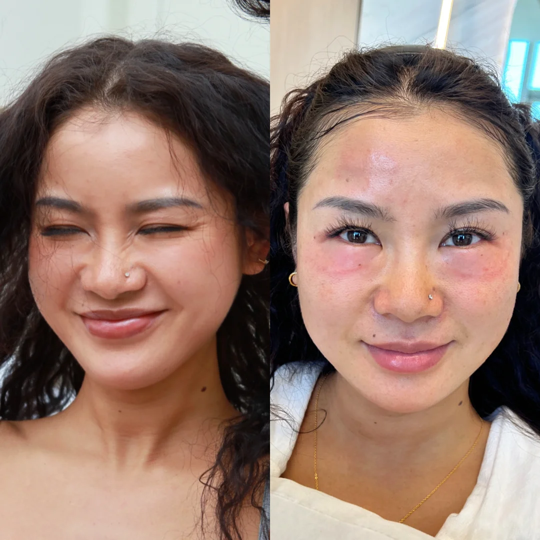 变美先变鬼，🐮胶原蛋白替你们先试过了