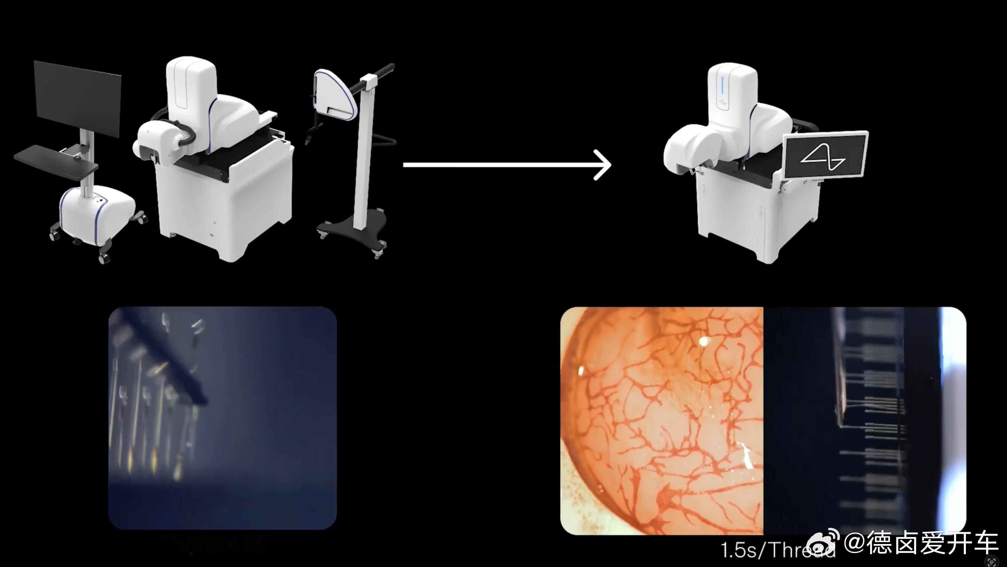 Neuralink 已准备好首次将全新的脑机接口芯片 Blindsight 植入