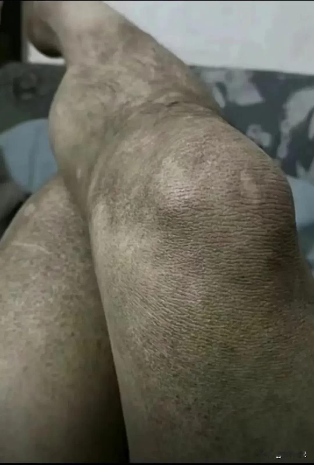 朋友们有没有什么可以快速美白的产品  推荐一下[泪奔]