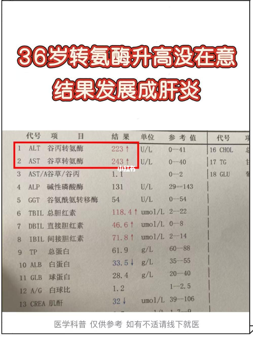 36岁转氨酶升高没在意，结果发展为肝炎！