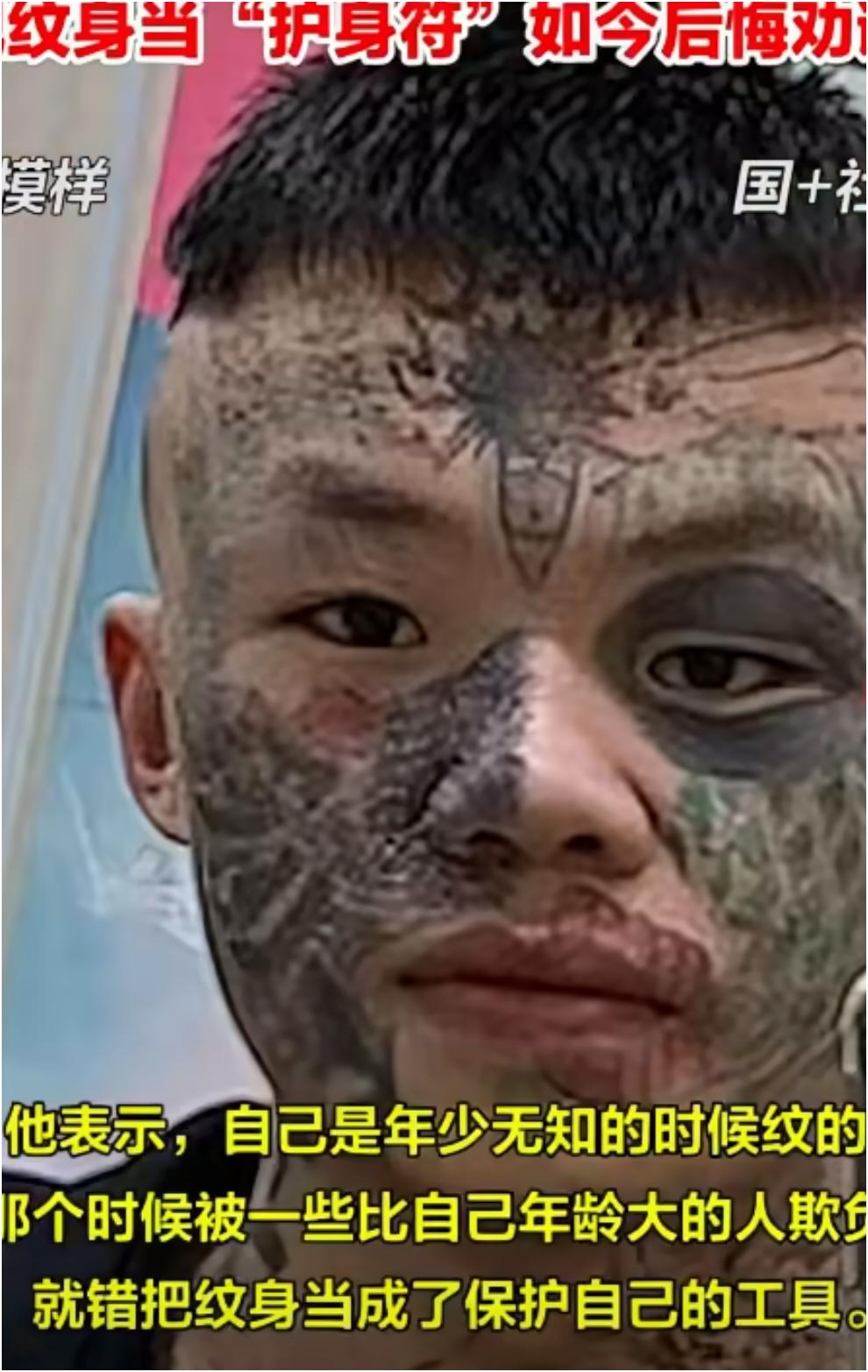 纹脸男孩夏朝勇又有新消息，说再洗两次文身就能洗干净啦。从照片看，三次清洗后，额头