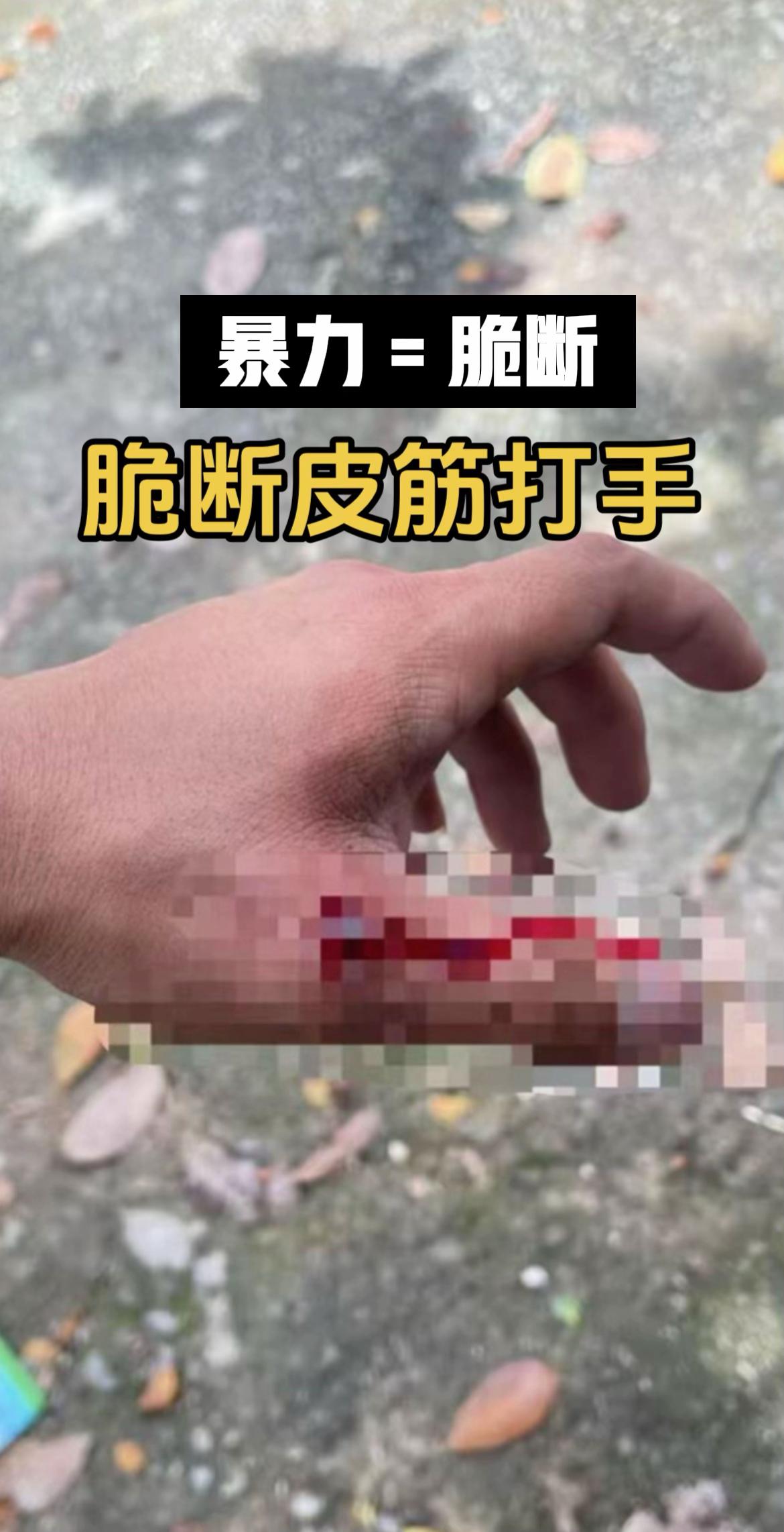 你的暴力皮筋脆断吗？皮筋脆断是一个很可怕的事情，后果非常严重。
其实常规玩家基本