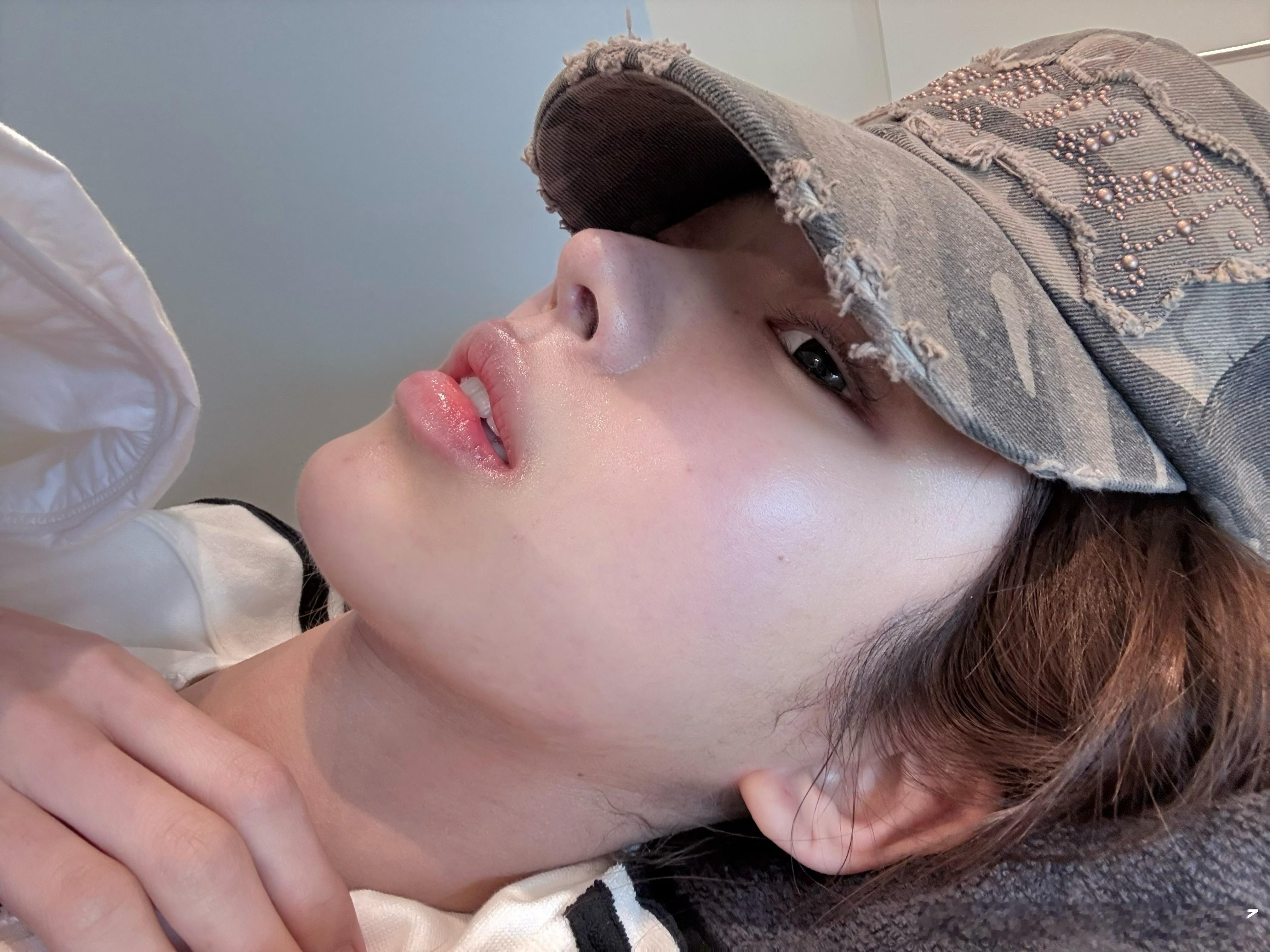 这次来做的项目..被拒了热玛吉水光也是间隔时间太短tuneface和vline都