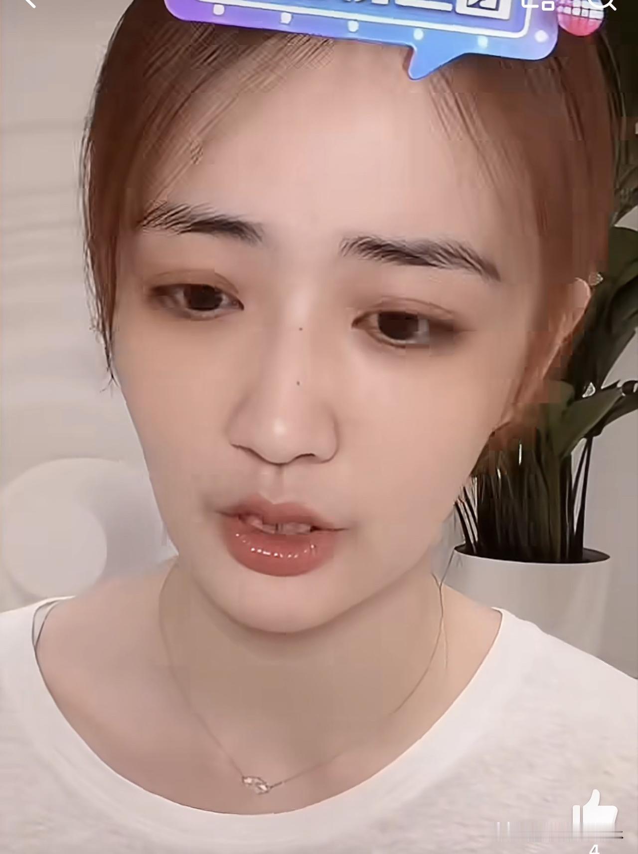 徐璐：我的黑眼圈是天生的，它是鼻炎导致的，有黑眼圈我觉得挺好的，元气满满，自带烟