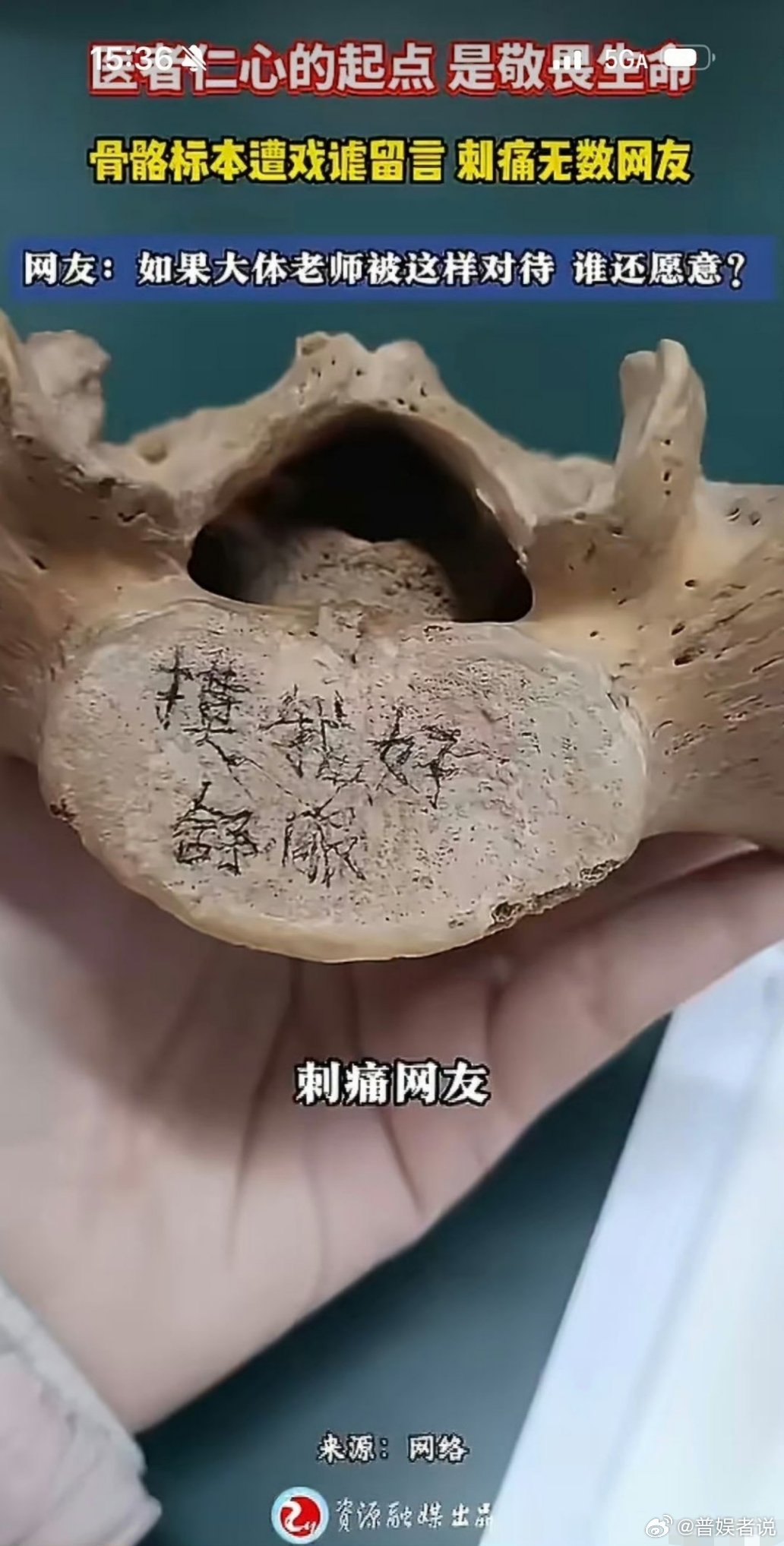 医学生把大体老师遗骨当玩物摆拍，这剧情像极了娱乐圈里那些靠滤镜硬撑、结果一上“理