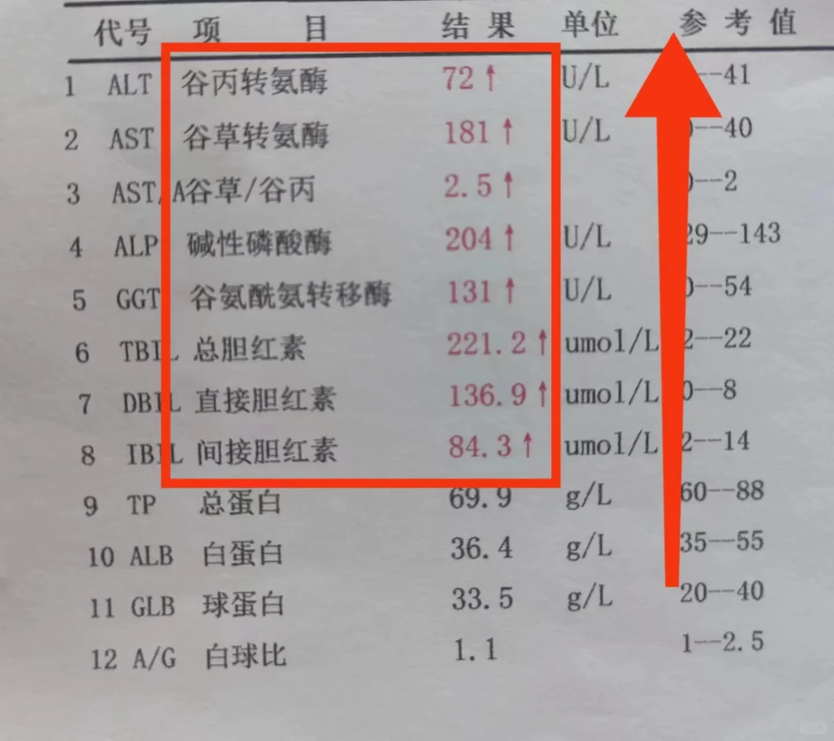 肝功能各项指标都出现异常！ 