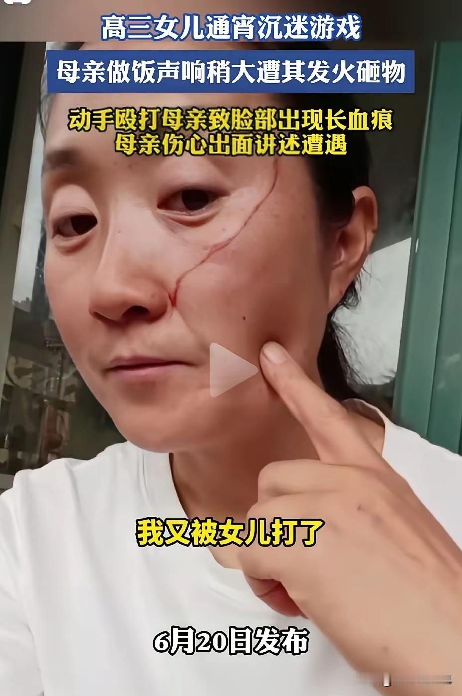 高三的女儿，沉迷于游戏，与母亲发生冲突，居然动手打了自己的母亲，还把母亲打伤了。