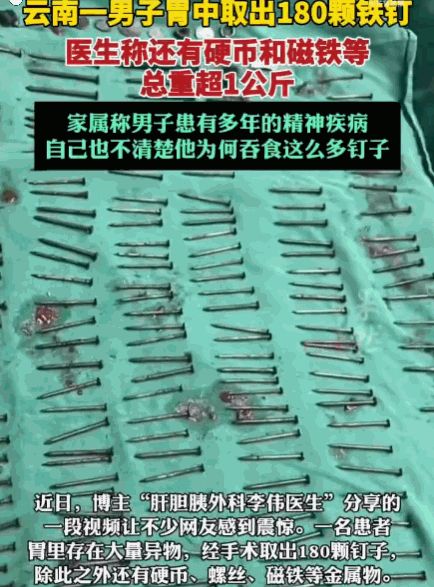 解释不清了！云南，一男子腹部剧痛送医，医生检查后当场被吓退三分：他体内居然塞满了