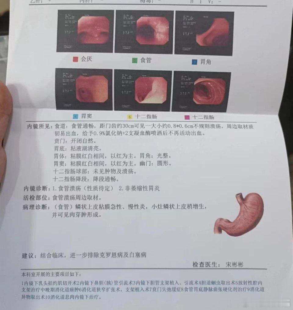 肉芽肿形成是一种组织学表现，指在病变部位出现了由多种细胞组成的局限性结节状病灶。