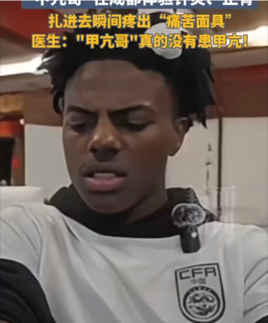 甲亢哥针灸正骨后已老实针灸哪里痛？针灸不痛啊…… ​​​