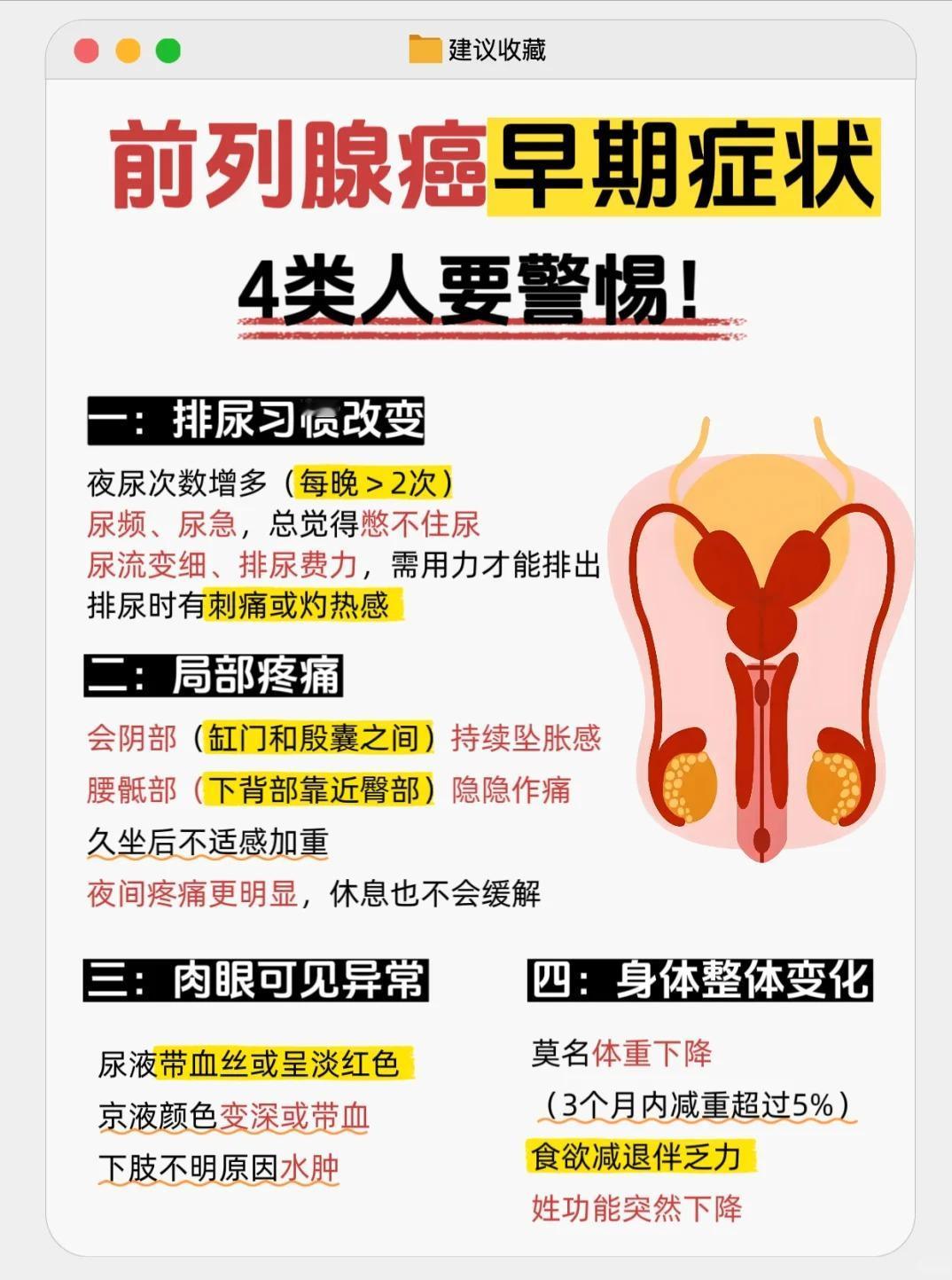 前列腺癌早期症状有哪些？这4类人要注意了！