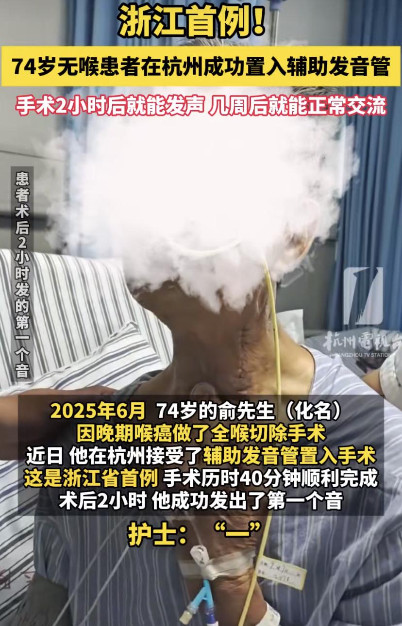 在杭州，一位74岁的俞大爷最近完成了一场特别的手术，让他重新找回了自己的声音。