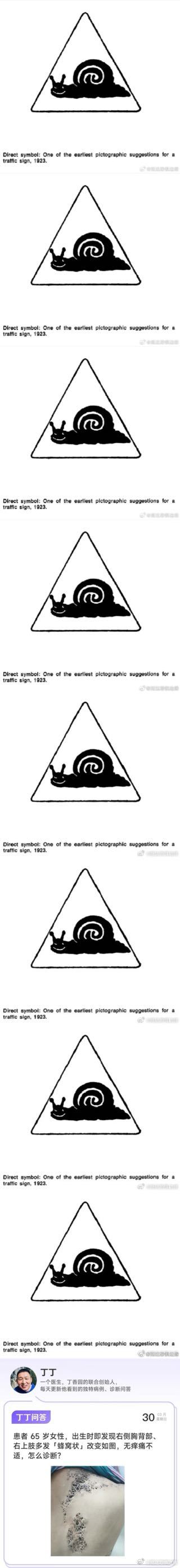 加了很多很多层防窥[泪]蜂窝状皮肤 ​​​