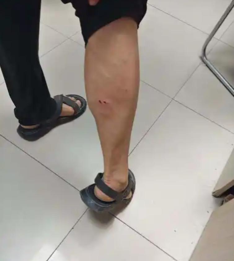 “离谱！不就咬了一下”？衡阳一宠物犬未牵绳咬伤路人，犬主拒赔医疗费以外损失，当地