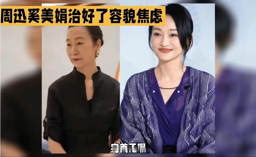周迅，奚美娟自然衰老好美