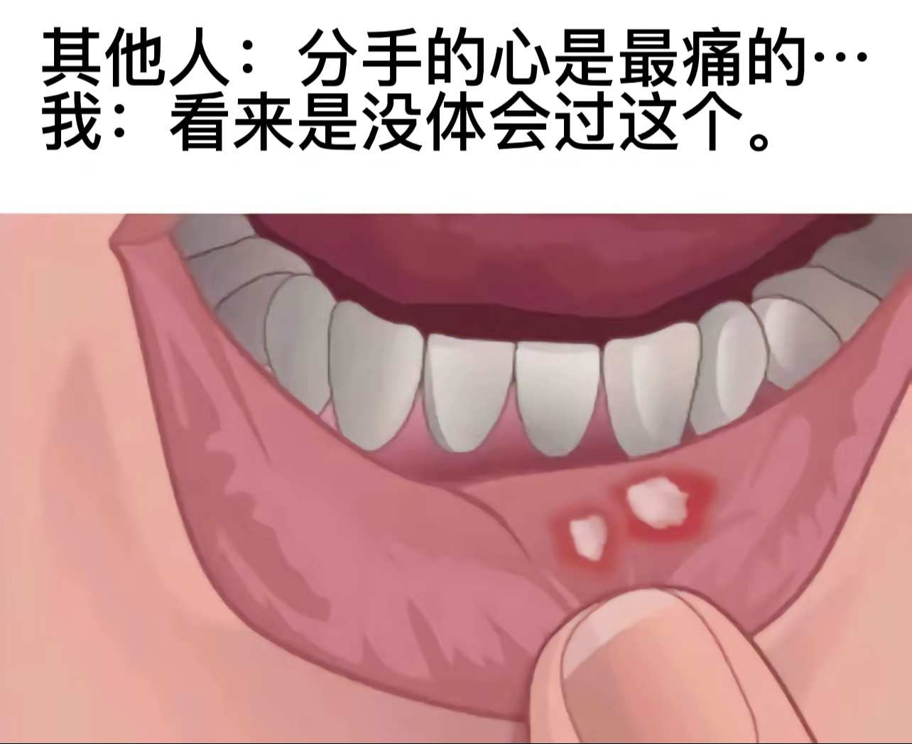 这个真痛#今日memes# //#v笑年度大赏# ​​​
