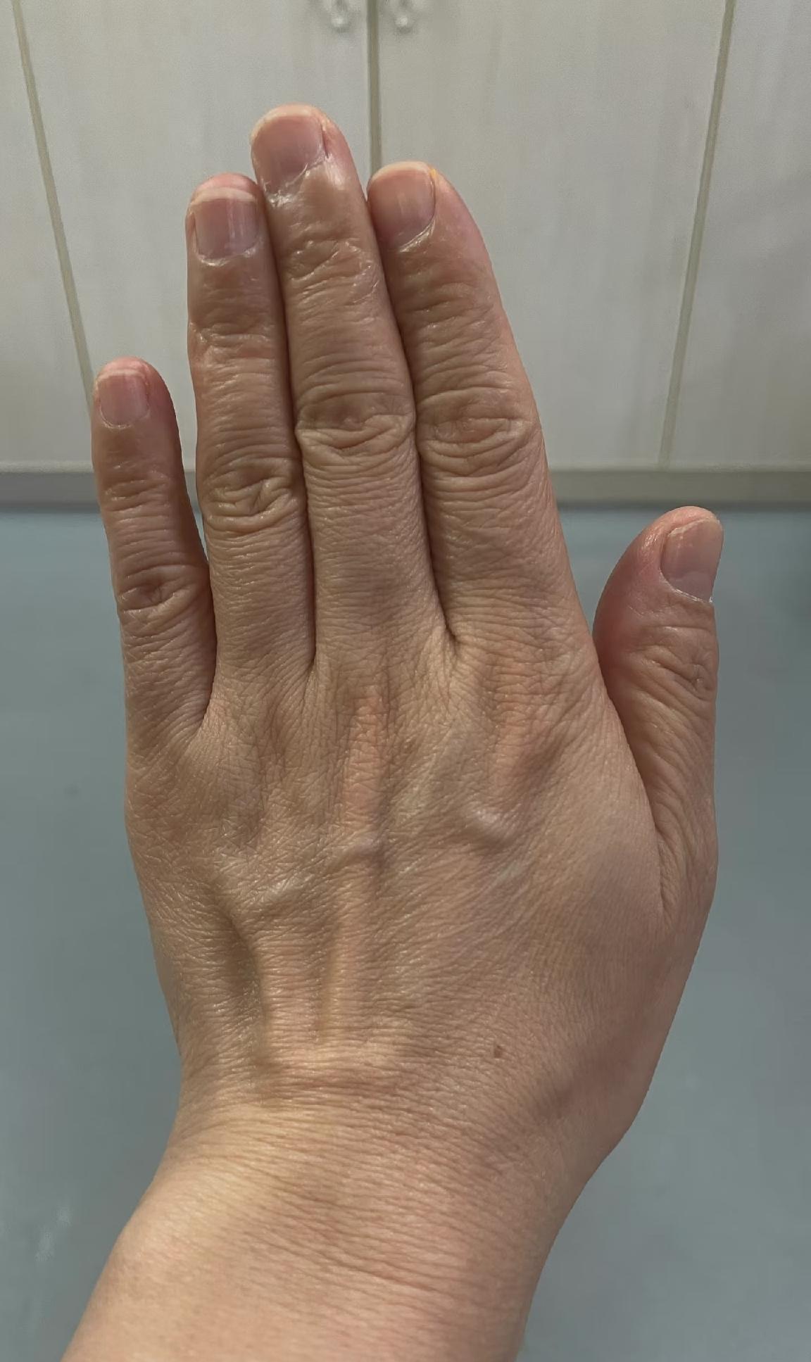 太崩溃了！

我是72年的牛，今年54岁，最近有一个令我特别痛苦的事，我不能睡觉