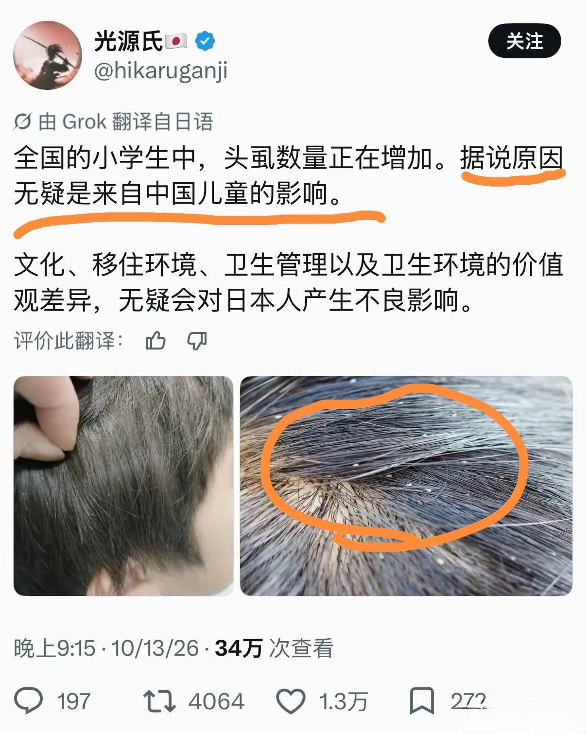 我们很难理解，作为发达国家的日本，小学生头生虱子的现象为何反倒日渐增多。

同样