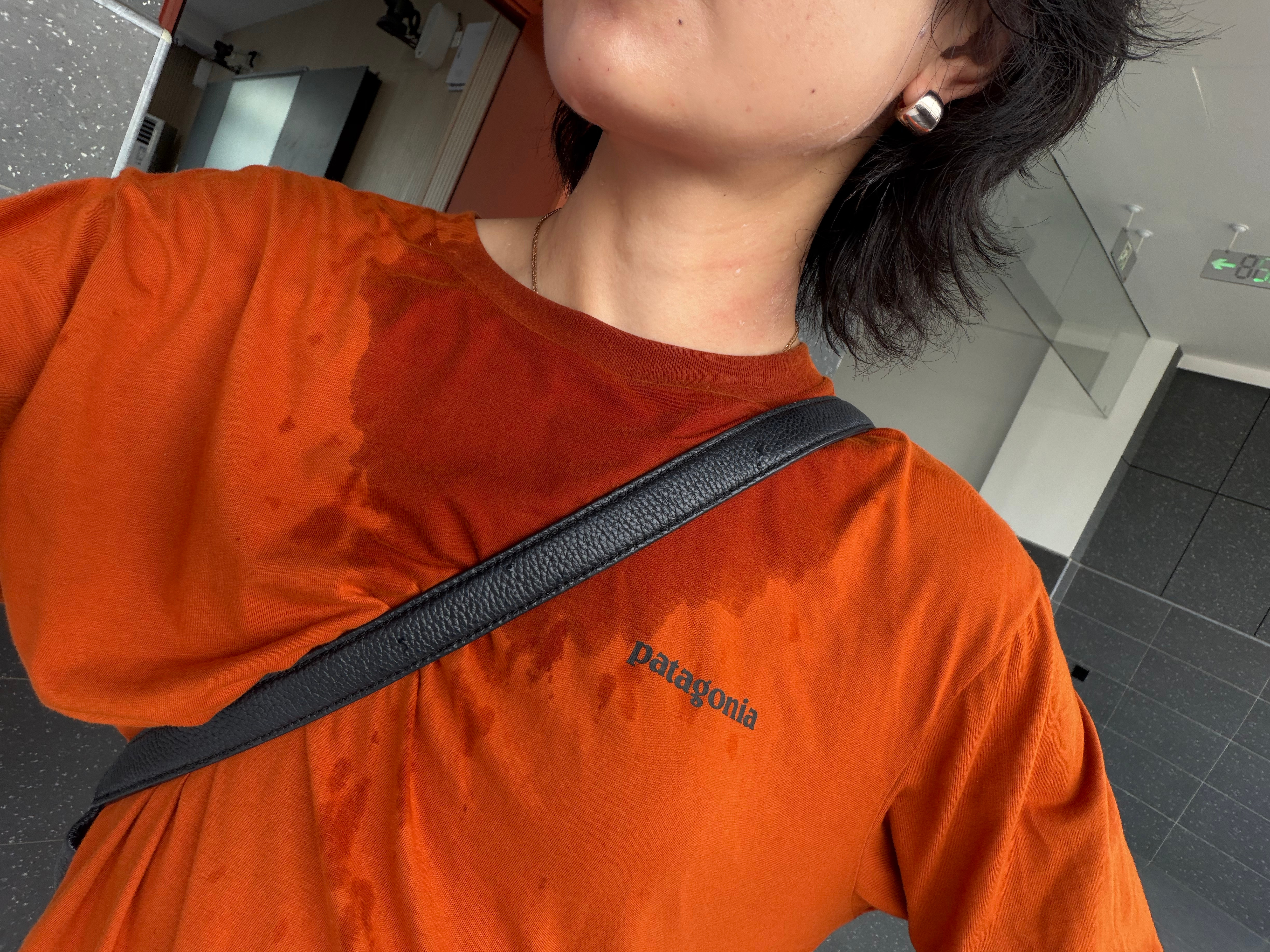 车又在修理店了前天被小等抓了一下，去打了针，嘱咐我不要喝咖啡做不到啊依然是每天古