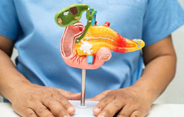 消化科主任：胰腺癌最危险信号，不是腹痛，而是频繁出现这3异常