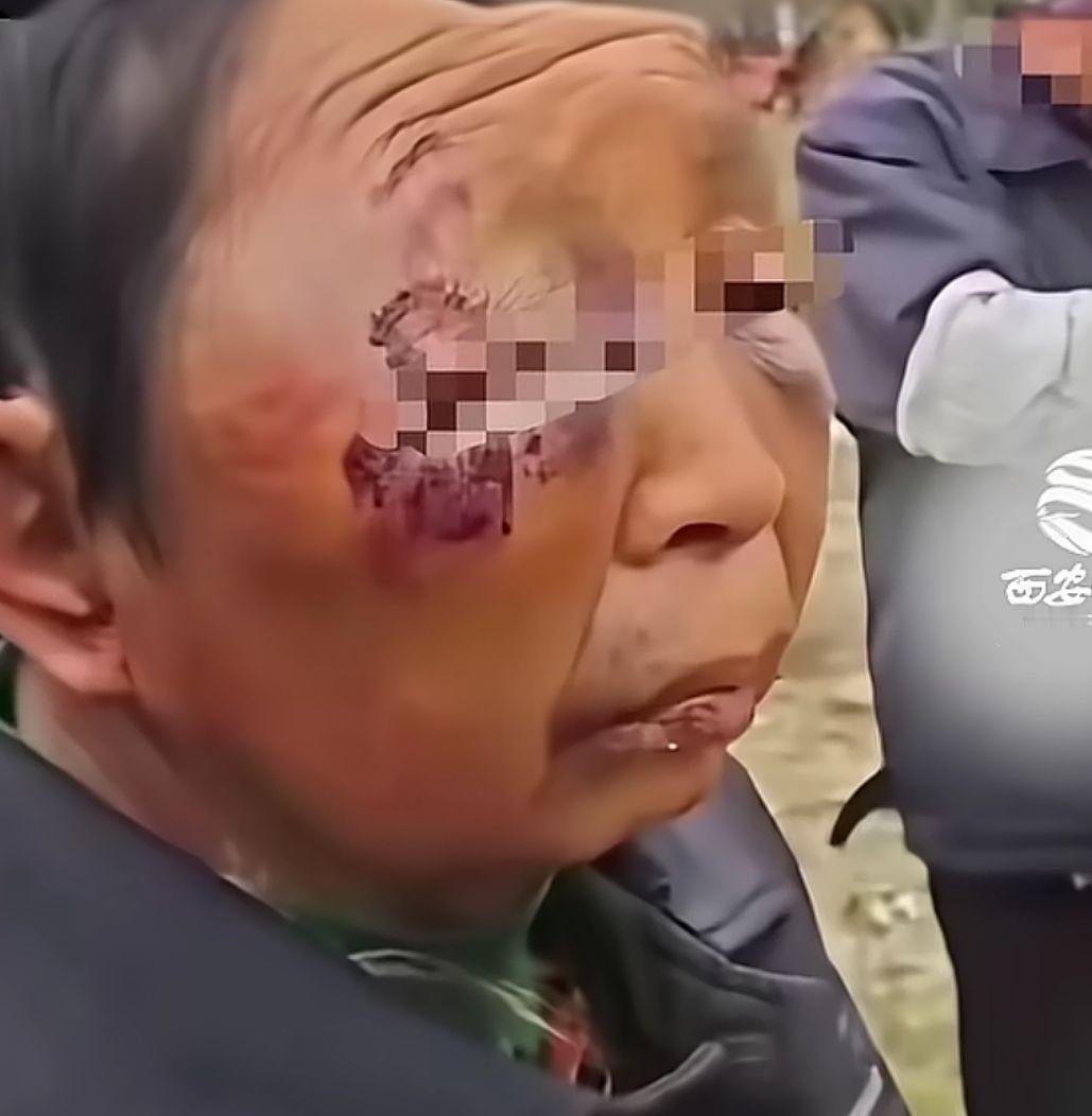 这是挨了多少打啊！
这就是没选对伴侣啊！
选对伴侣幸福一生，选错伴侣痛苦一生！