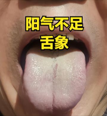补阳我从不用桂附地黄汤，教你一个更好的，帮你补足一身阳气

阳气对我们人体很重要