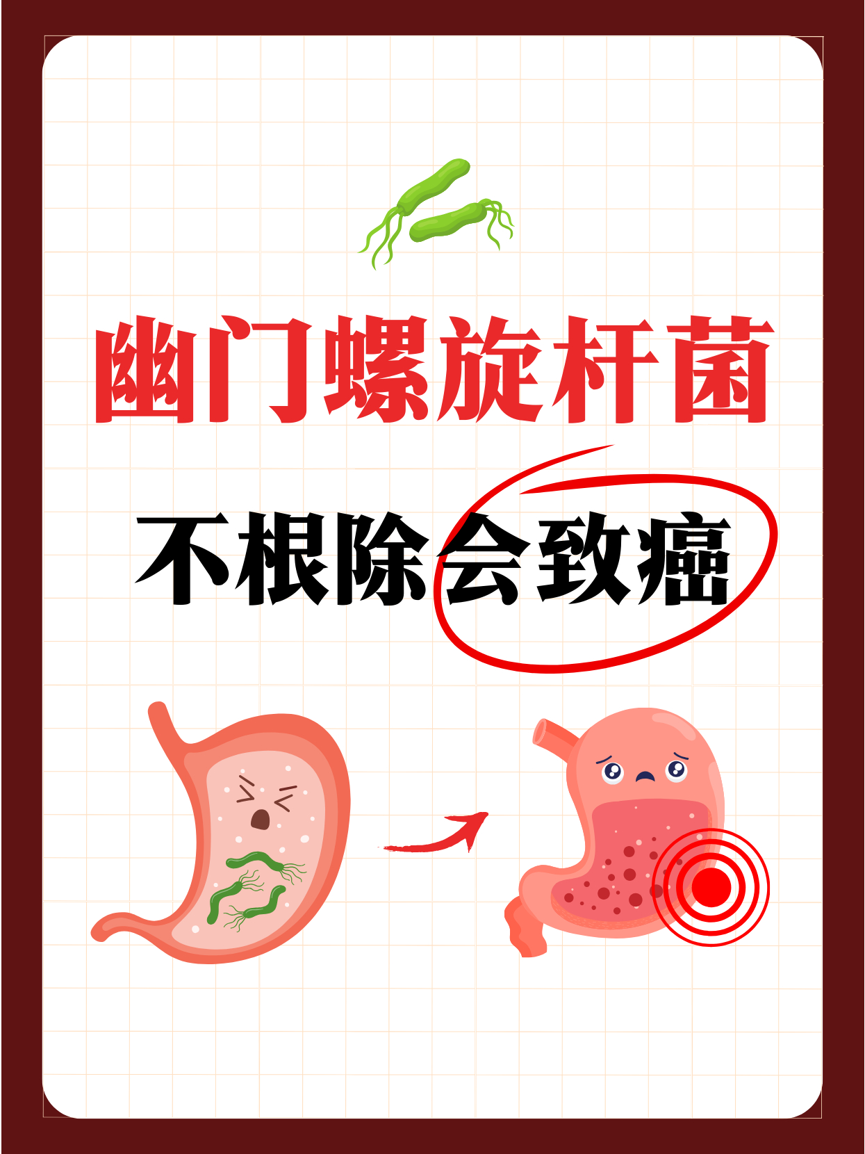 幽门螺杆菌致癌❗你还留着它干啥呢⚠ 