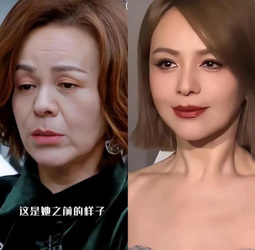 雪姨在哪做的医美啊，这个效果也太好了吧！就像换了一个人似的，54岁直接变24，2